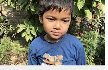 Denish Chaudhary, age 5, from Bhajani 4, Kundi, Nepal