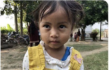 Ritbi Chaudhary, age 3, from Kundi, Nepal